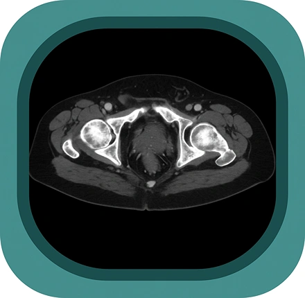 CT male pelvis anatomy icon